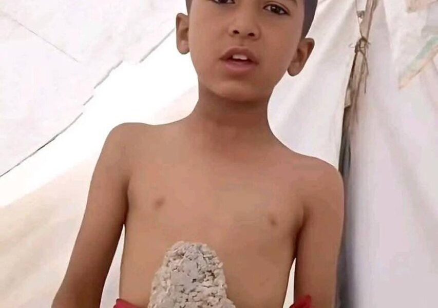 مقاومت با طعم گرسنگی