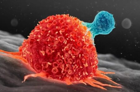 تشخیص این بیماری مهلک با «نور» امکان‌پذیر شد