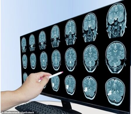 این داروی ایرانی آلزایمر را ۲۰ سال زودتر شناسایی می‌کند