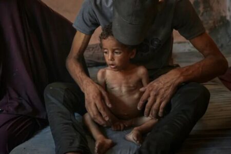 شهادت ۲۲۷ نفر در غزه به دلیل گرسنگی و سوء تغذیه