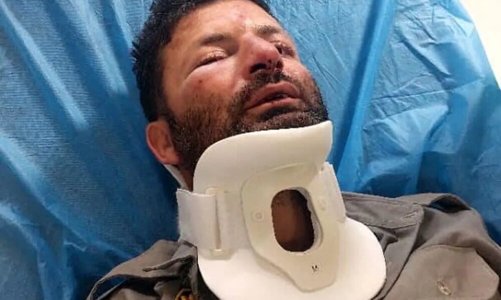 حمله بی‌رحمانه ۳ نفر به مامور قانون؛ یک محیط‌بان به جرم حفاظت از طبیعت تا پای مرگ رفت
