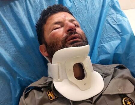حمله بی‌رحمانه ۳ نفر به مامور قانون؛ یک محیط‌بان به جرم حفاظت از طبیعت تا پای مرگ رفت