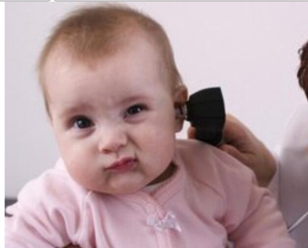 سالانه ۴۰۰ هزار کودک محروم غربالگری رایگان شنوایی میشوند