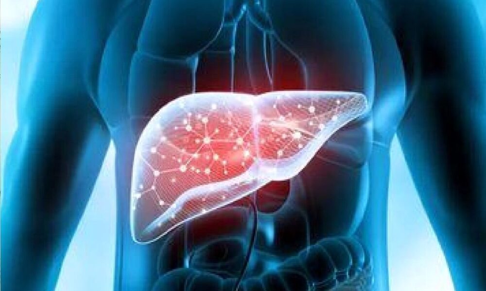 با این روش‌ها حال کبدتان را خوب کنید