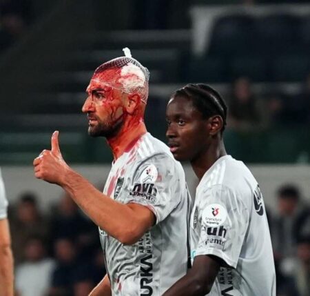 مصدومیت دلخراش بازیکن پرسپولیسی را غرق در خون کرد +عکس