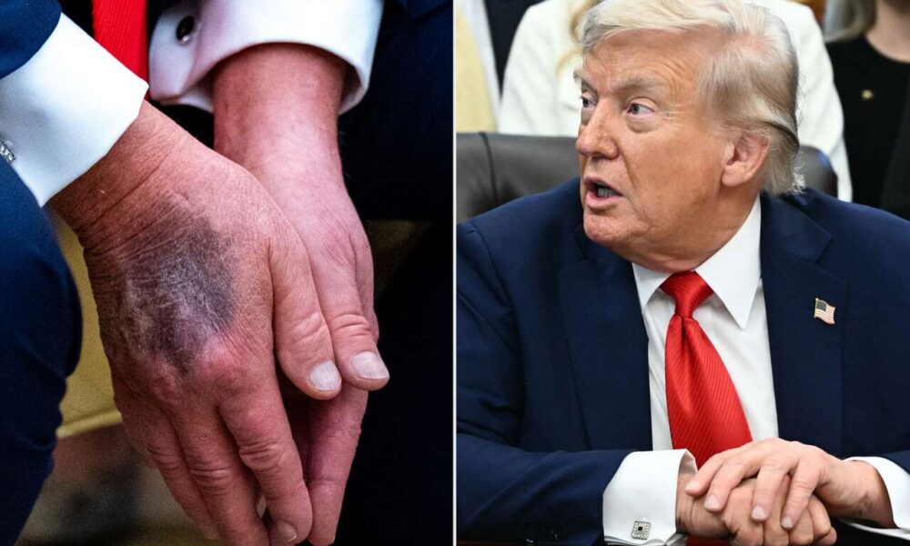 ترامپ از اواخر اوت حداقل ۸۲ میلیون دلار اوراق قرضه خریداری کرد ترامپ از اواخر اوت حداقل ۸۲ میلیون دلار اوراق قرضه خریداری کرد