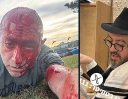 کشته شدن خاخام اسرائیلی در «حنوکای خونین» و زخمی شدن رئیس شورای یهودیان استرالیا-اسرائیل