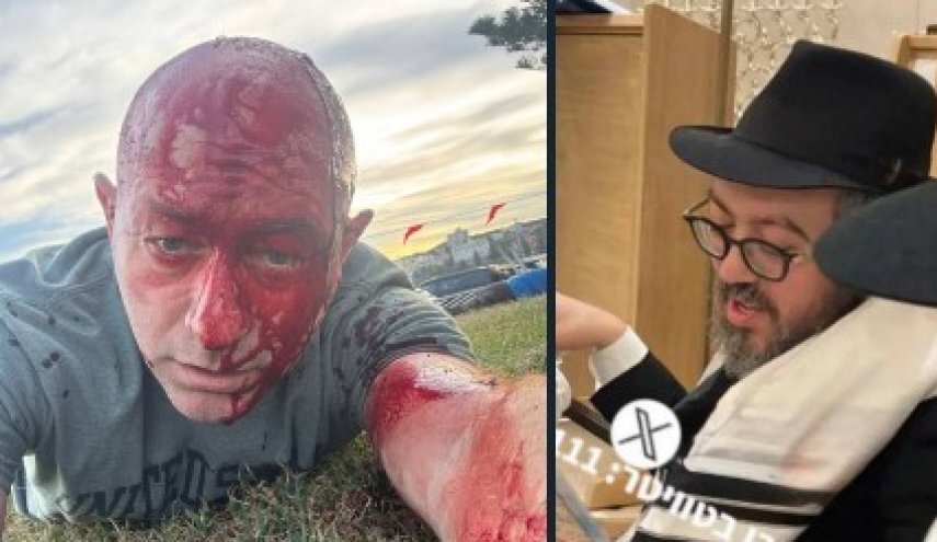 کشته شدن خاخام اسرائیلی در «حنوکای خونین» و زخمی شدن رئیس شورای یهودیان استرالیا-اسرائیل کشته شدن خاخام اسرائیلی در «حنوکای خونین» و زخمی شدن رئیس شورای یهودیان استرالیا-اسرائیل