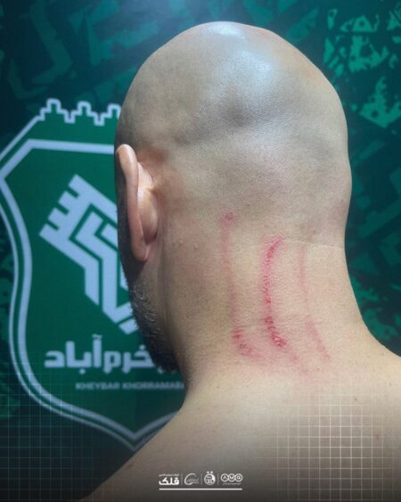 حمله به کادر استقلال بعد از تساوی برابر خیبر +عکس