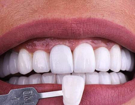 نماینده‌ای که کلینیک دندانپزشکی متخلف را تبلیغ کرد،که بود؟