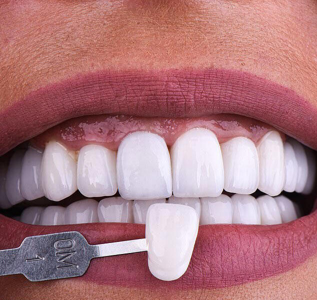 نماینده‌ای که کلینیک دندانپزشکی متخلف را تبلیغ کرد،که بود؟