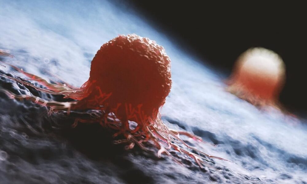 غذاهای ناسالمی که خطر ابتلا به این بیماری هولناک را افزایش می‌دهند