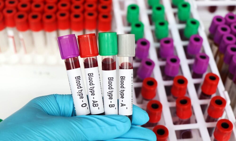 مشکلات ارزی کیفیت خدمات آزمایشگاهی را هم تهدید می‌کند