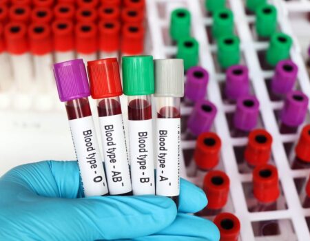 مشکلات ارزی کیفیت خدمات آزمایشگاهی را هم تهدید می‌کند